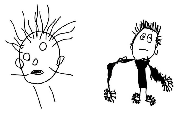 图3-4 “头发生长型”和“多指型”人物画 “头发生长型”和“多指型”人物画