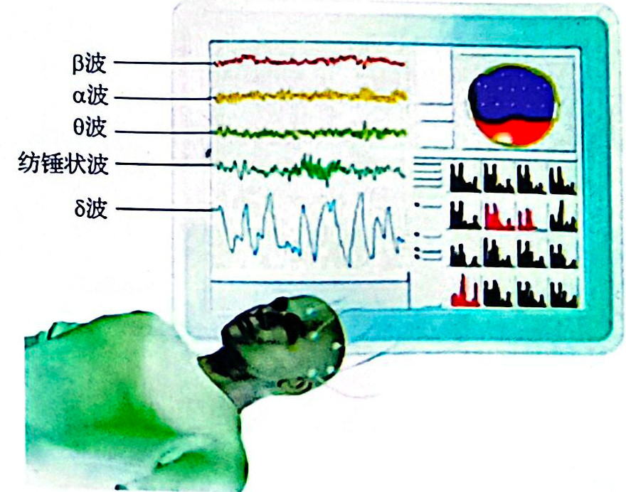 睡眠过程中脑电波的变化